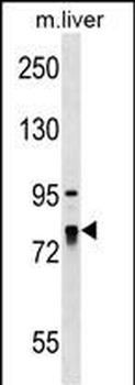 LARP4 Antibody (C-term)