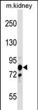 PNPT1 Antibody (Center)
