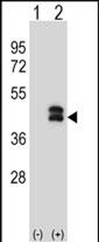 DUSP6 Antibody (N-term)