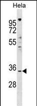 IMPACT Antibody (N-term)