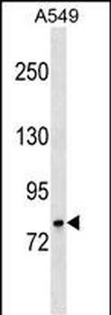 GLB1 Antibody (N-term)