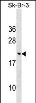 CNIH3 Antibody (N-term)