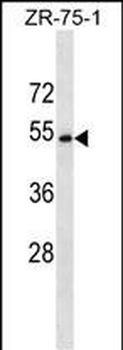 CCDC112 Antibody (N-term)