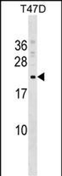 COMMD9 Antibody (C-term)