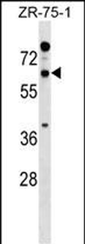 RTN2 Antibody (N-term)