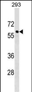 CACNB3 Antibody (C-term)