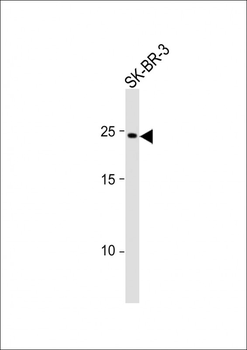 RAB32 Antibody (N-term)