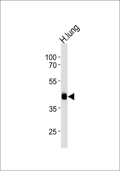 MTRF1 Antibody (Center)