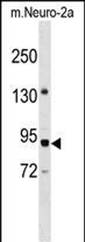 PWP2 Antibody (Center)