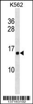 HIST1H2AB Antibody (N-term)