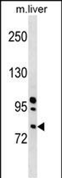 Mouse Rnasel Antibody (N-term)