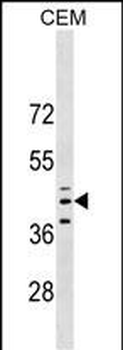 QPCT Antibody (C-term)