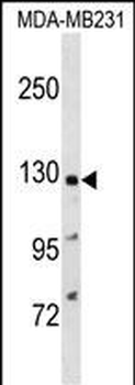 PPFIA1 Antibody (N-term)