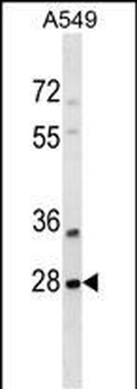 SNF8 Antibody (N-term)