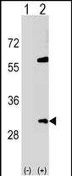 SNF8 Antibody (N-term)