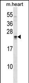SOSTDC1 Antibody (C-term)