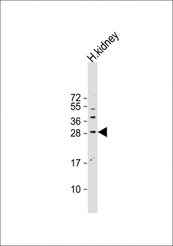 SOST Antibody (N-term)