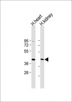 AADACL2 Antibody (Center)