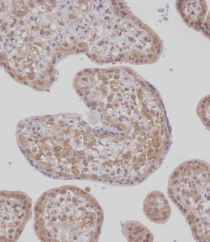 TET2 Antibody (N-term)