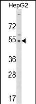 GLTSCR2 Antibody (C-term)