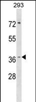 HYI Antibody (N-term)