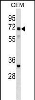 NPLOC4 Antibody (C-term)