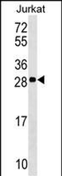 ANP32C Antibody (Center)