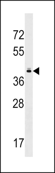 TAS2R10 Antibody (Center)