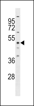 RBM23 Antibody (Center)