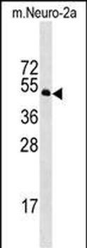 Mouse Stk39 Antibody (C-term)