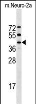Mouse Stk32a Antibody (C-term)