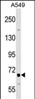 TNFRSF21 Antibody (Center)