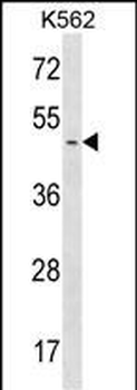 PPME1 Antibody (C-term)
