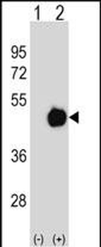 PPME1 Antibody (C-term)