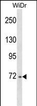 DDX4 Antibody (N-term)