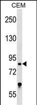 TCF25 Antibody (N-term)