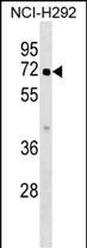 ZBTB44 Antibody (C-term)