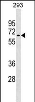 RNF168 Antibody (C-term)