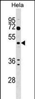 ALG2 Antibody (Center)