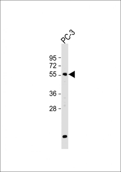 GPNMB Antibody (C-term)