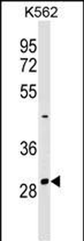 NRIP2 Antibody (Center)