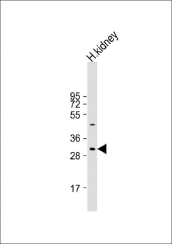 NRIP2 Antibody (Center)