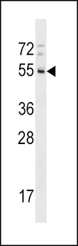 RHD Antibody (Center)