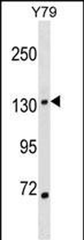 SALL1 Antibody (N-term)