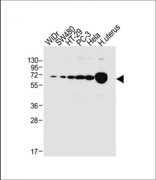 NOX1 Antibody (Center)