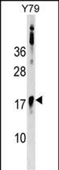BCL7B Antibody (C-term)