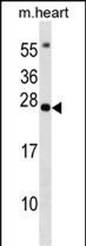 BCL7B Antibody (C-term)