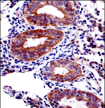 PHF16 Antibody (C-term)
