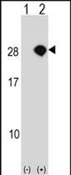 AKIRIN2 Antibody (C-term)