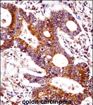 CEACAM7 Antibody (Center)